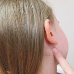 test allergic reaction behind ear