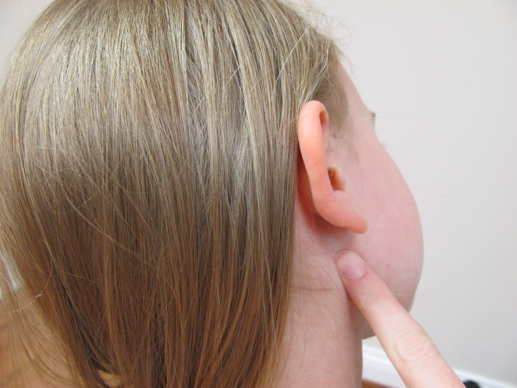 test allergic reaction behind ear