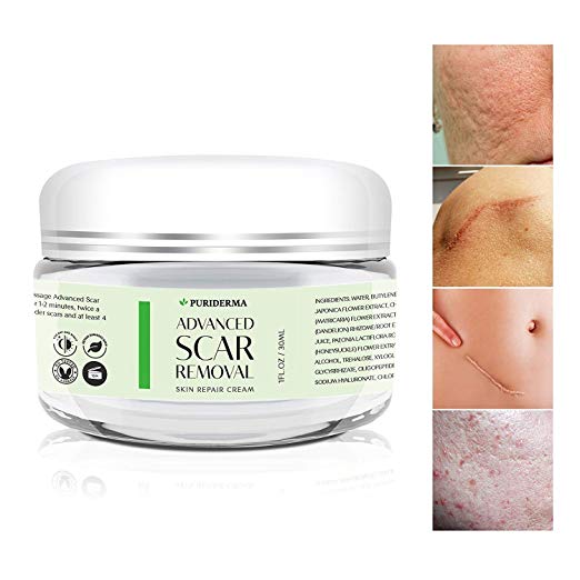 Puriderma scar removal cream